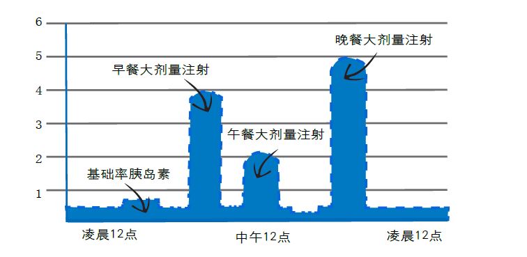 胰島素泵治療